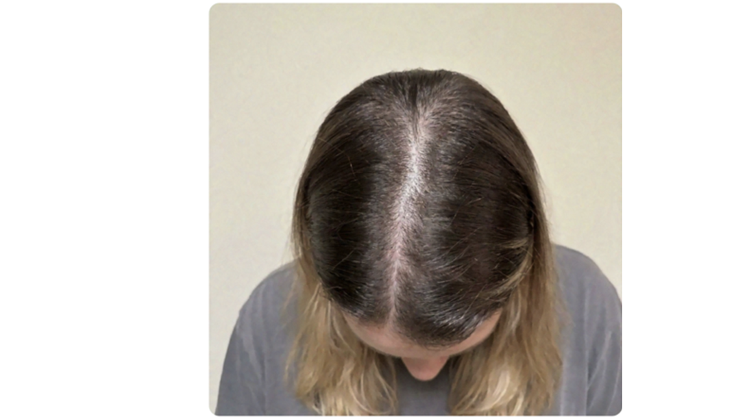Participant 2 before treatment