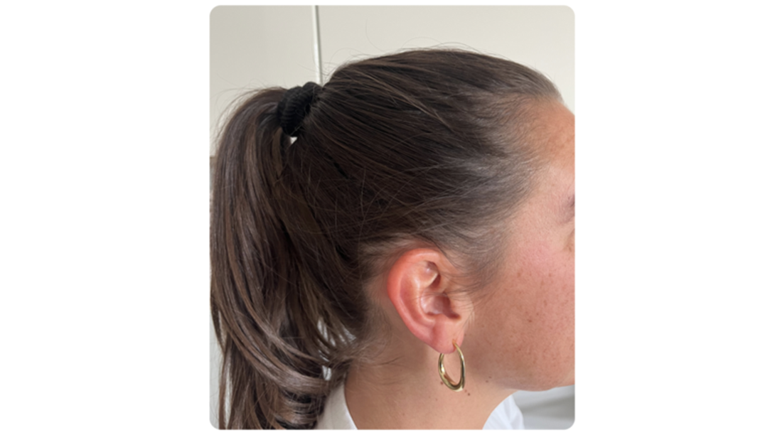 Participant 4 after treatment