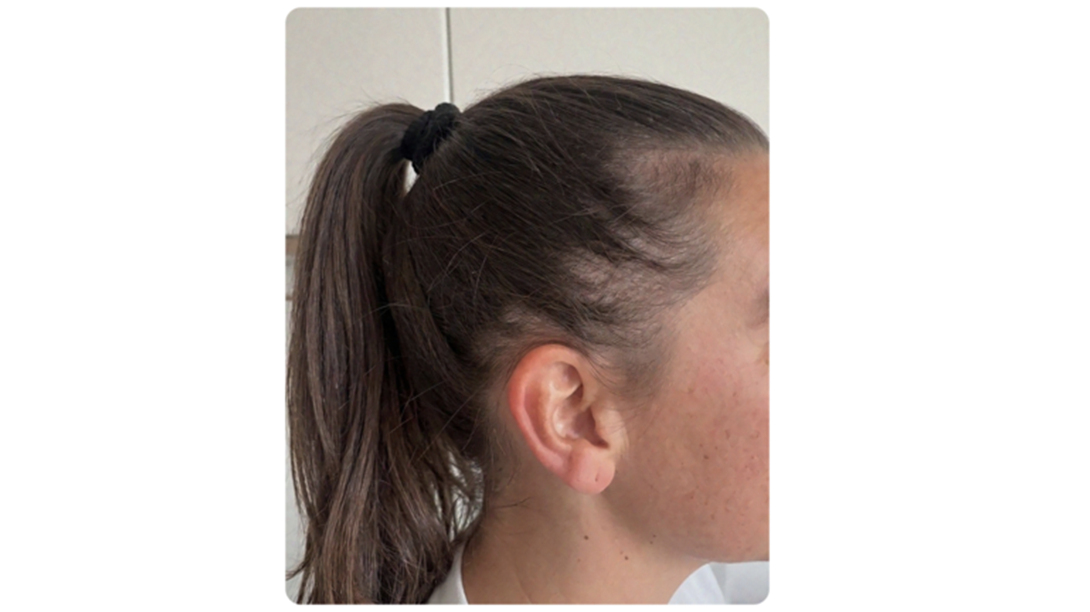 Participant 4 before treatment